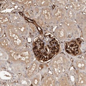 Anti-ZNF557 antibody produced in rabbit 