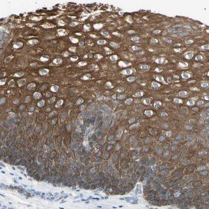 Anti-ZNF558 antibody produced in rabbit 