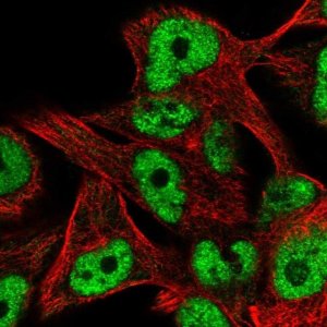 Anti-ZNF559 antibody produced in rabbit 