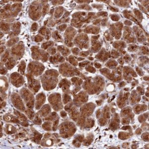 Anti-ZNF565 antibody produced in rabbit HPA044123-100UL