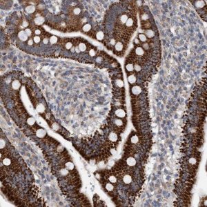 Anti-ZNF566 antibody produced in rabbit 