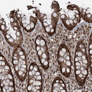 Anti-ZNF570 antibody produced in rabbit 