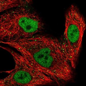 Anti-ZNF574 antibody produced in rabbit 