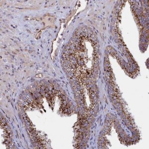 Anti-ZNF577 antibody produced in rabbit HPA041499-100UL