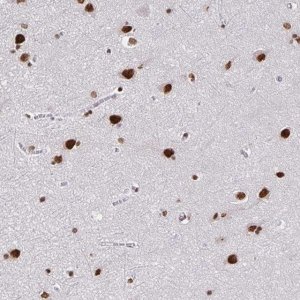 Anti-ZNF579 antibody produced in rabbit 