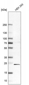 Anti-ZNF581 antibody produced in rabbit HPA059657-100UL