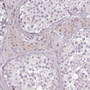 Anti-ZNF583 antibody produced in rabbit 
