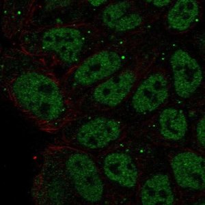 Anti-ZNF585B antibody produced in rabbit 