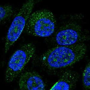 Anti-ZNF586 antibody produced in rabbit 