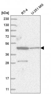 Anti-ZNF586 antibody produced in rabbit 