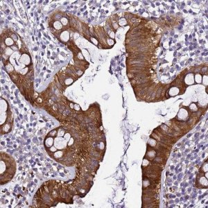 Anti-ZNF587 antibody produced in rabbit 
