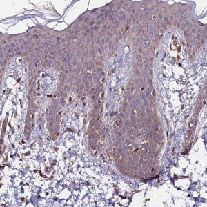 Anti-ZNF598 antibody produced in rabbit 