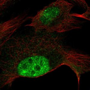 Anti-ZNF606 antibody produced in rabbit 