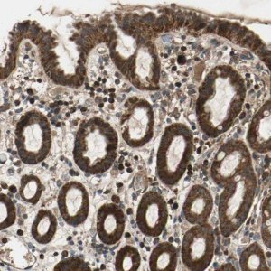 Anti-ZNF608 antibody produced in rabbit 