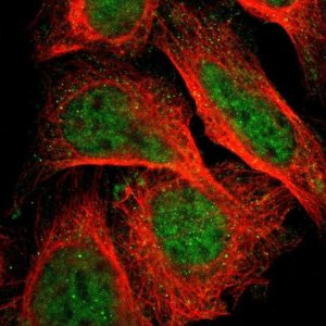 Anti-ZNF608 antibody produced in rabbit 