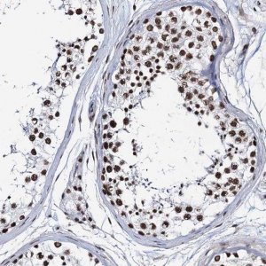 Anti-ZNF609 antibody produced in rabbit 