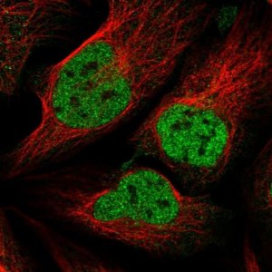 Anti-ZNF609 antibody produced in rabbit 