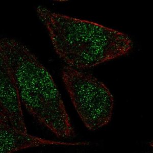 Anti-ZNF610 antibody produced in rabbit 