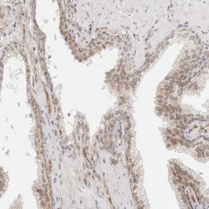 Anti-ZNF613 antibody produced in rabbit 