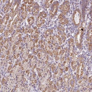 Anti-ZNF615 antibody produced in rabbit 