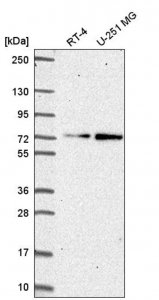 Anti-ZNF616 antibody produced in rabbit 