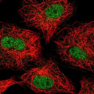 Anti-ZNF618 antibody produced in rabbit 