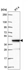 Anti-ZNF618 antibody produced in rabbit 