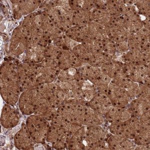 Anti-ZNF619 antibody produced in rabbit 