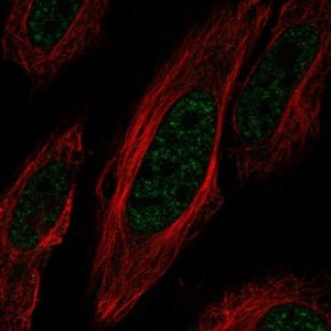 Anti-ZNF621 antibody produced in rabbit HPA071440-100UL