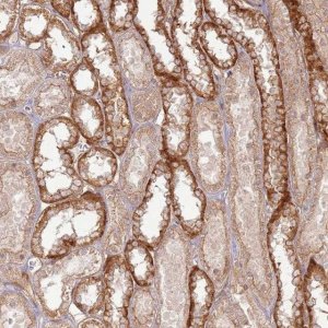 Anti-ZNF623 antibody produced in rabbit 