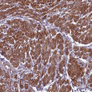 Anti-ZNF626 antibody produced in rabbit 