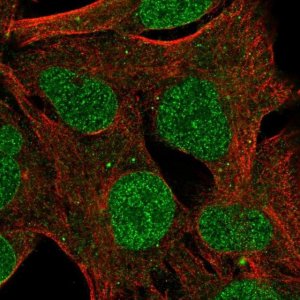 Anti-ZNF626 antibody produced in rabbit 