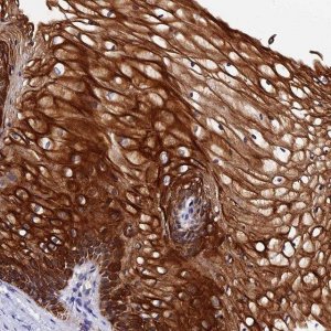 Anti-ZNF628 antibody produced in rabbit 