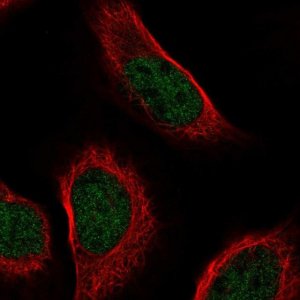 Anti-ZNF628 antibody produced in rabbit 