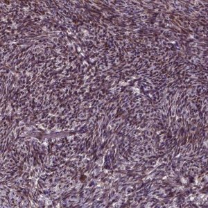 Anti-ZNF630 antibody produced in rabbit 