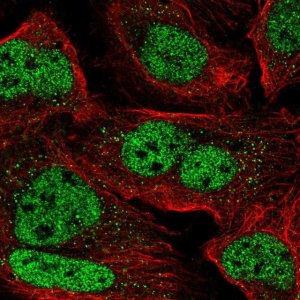 Anti-ZNF638 antibody produced in rabbit 