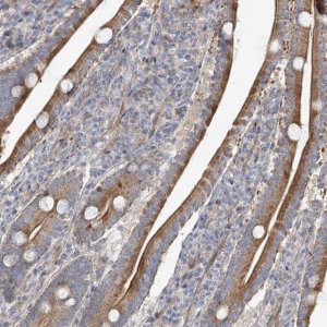 Anti-ZNF641 antibody produced in rabbit 