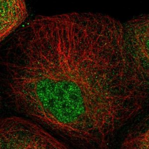 Anti-ZNF641 antibody produced in rabbit 