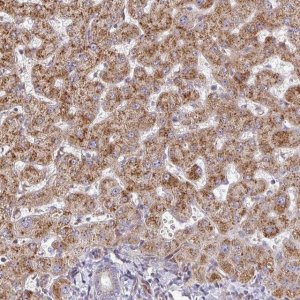 Anti-ZNF644 antibody produced in rabbit 