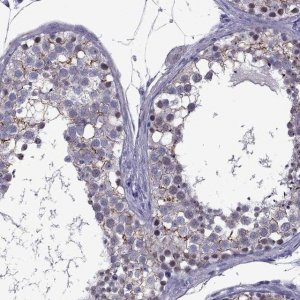 Anti-ZNF646 antibody produced in rabbit 