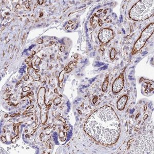 Anti-ZNF652 antibody produced in rabbit 