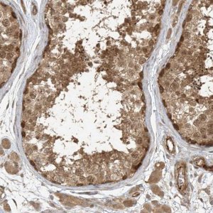 Anti-ZNF653 antibody produced in rabbit 