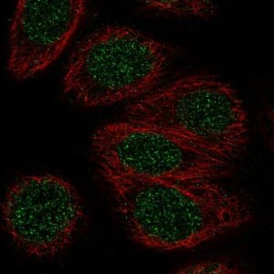 Anti-ZNF653 antibody produced in rabbit 