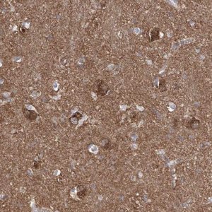 Anti-ZNF653 antibody produced in rabbit HPA023635-100UL