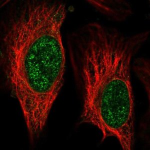 Anti-ZNF653 antibody produced in rabbit HPA023635-100UL