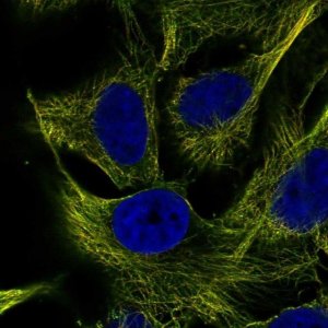 Anti-ZNF654 antibody produced in rabbit 