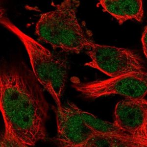 Anti-ZNF655 antibody produced in rabbit 