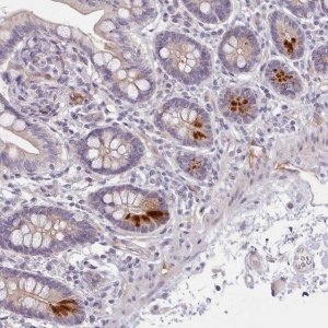 Anti-ZNF658 antibody produced in rabbit 