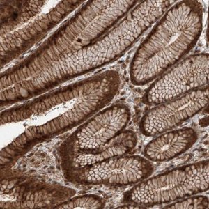 Anti-ZNF660 antibody produced in rabbit 