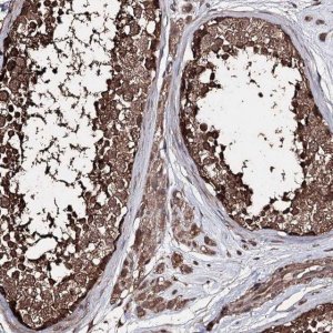 Anti-ZNF662 antibody produced in rabbit 